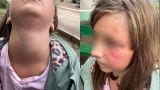 Разбойник оказался педофилом: нападение на 9-летнюю школьницу в Солнечногорске